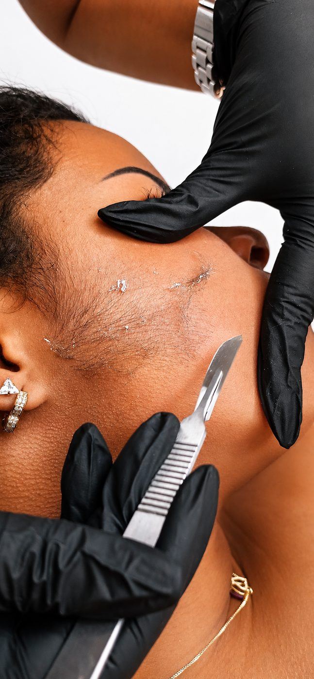 Dermaplaning